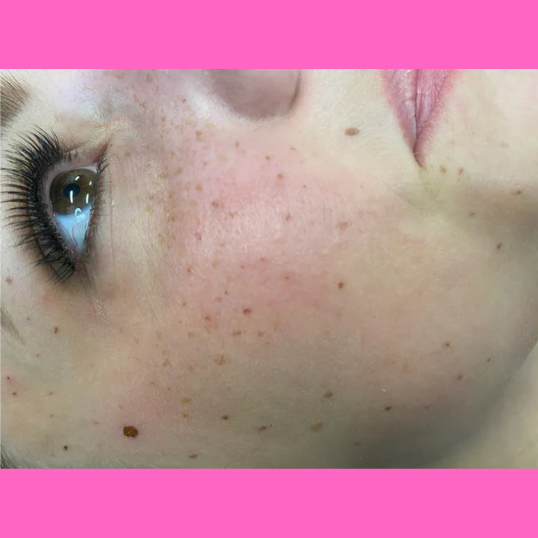 PMU Freckles & Beauty Marks Online Training - imagebykelz