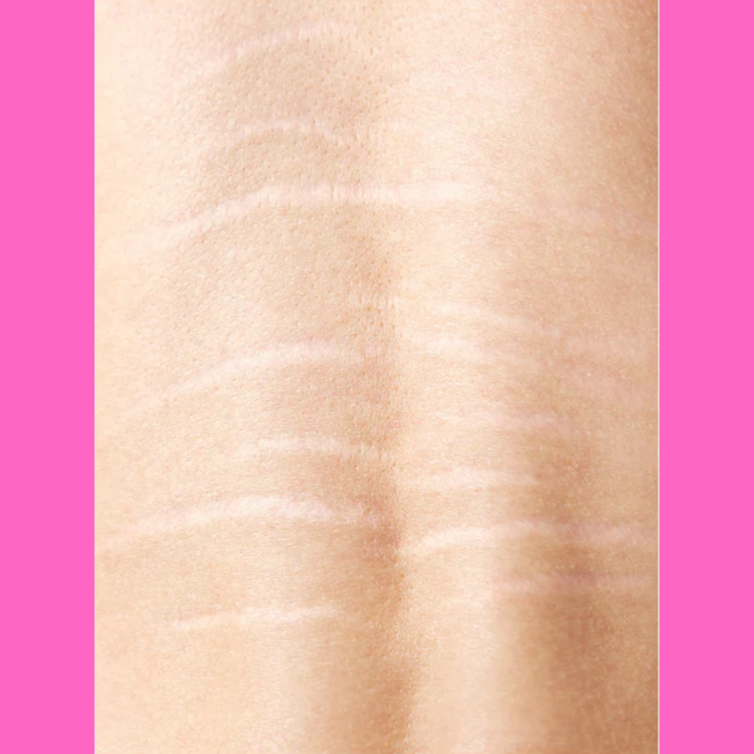 Paramedical Scar Camouflage Class Sign Up - imagebykelz