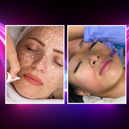COMBO Microneedling plus BB GLOW Nano Infusion Kit + Training - imagebykelz