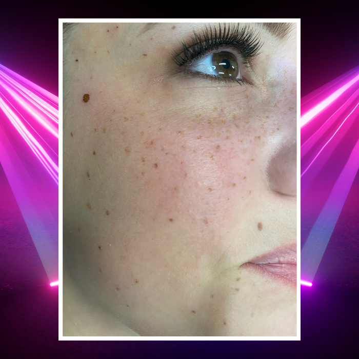 PMU Freckles & Beauty Marks Training - imagebykelz